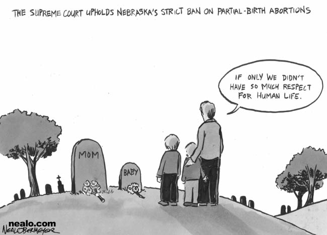 partial birth abortion supreme court
